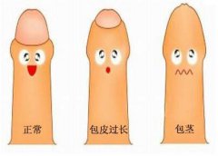 患有包皮過(guò)長(zhǎng)日常需如何護(hù)理？